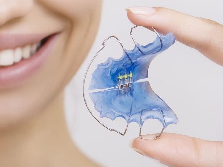 Apparecchio Mobile a Modica (Ragusa) - Centro Odontoiatrico Pitino