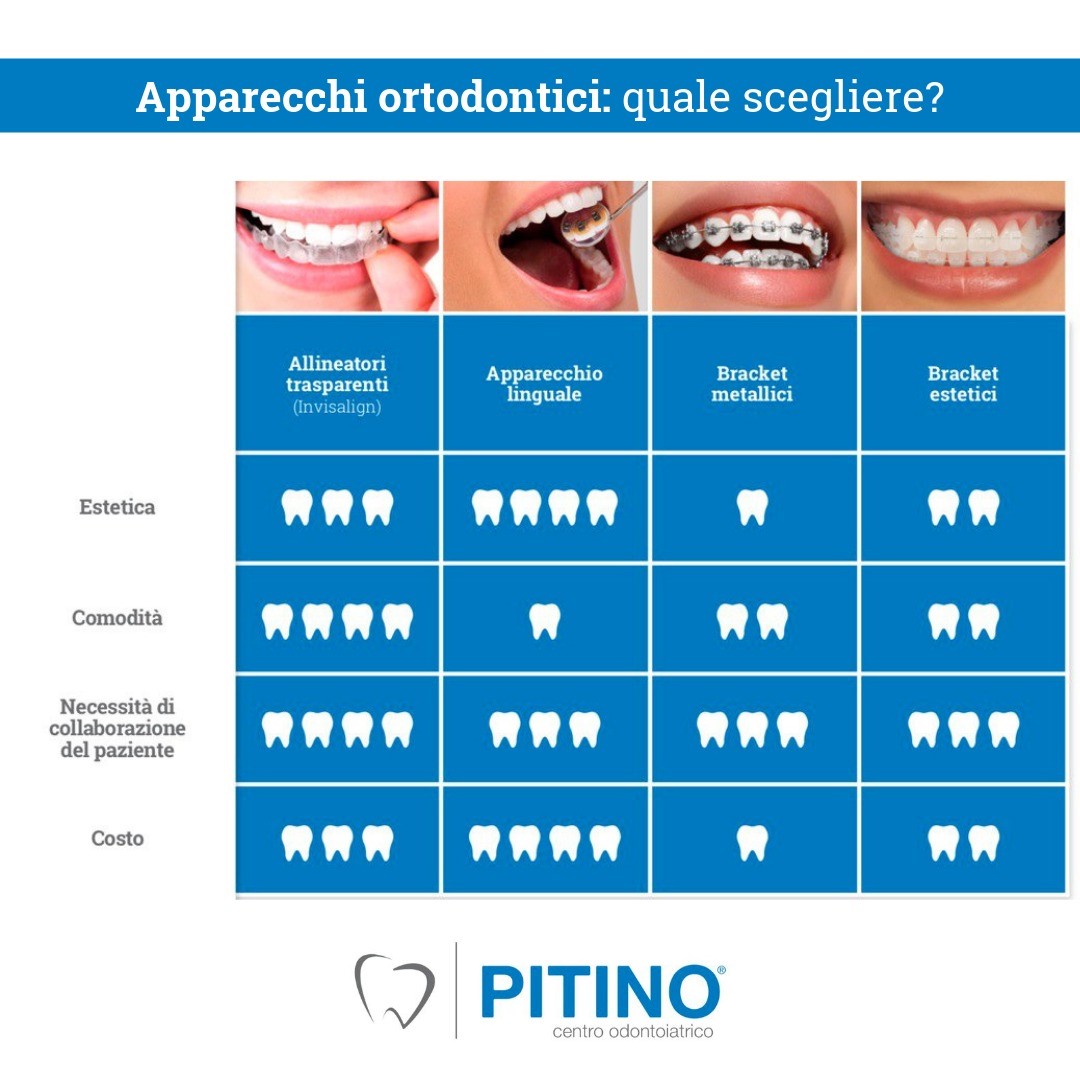 Qual è il costo di un apparecchio denti? Le varie tipologie - Centri  Dentistici Primo