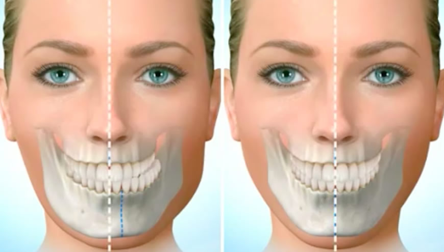 La chirurgia maxillo facciale prima e dopo