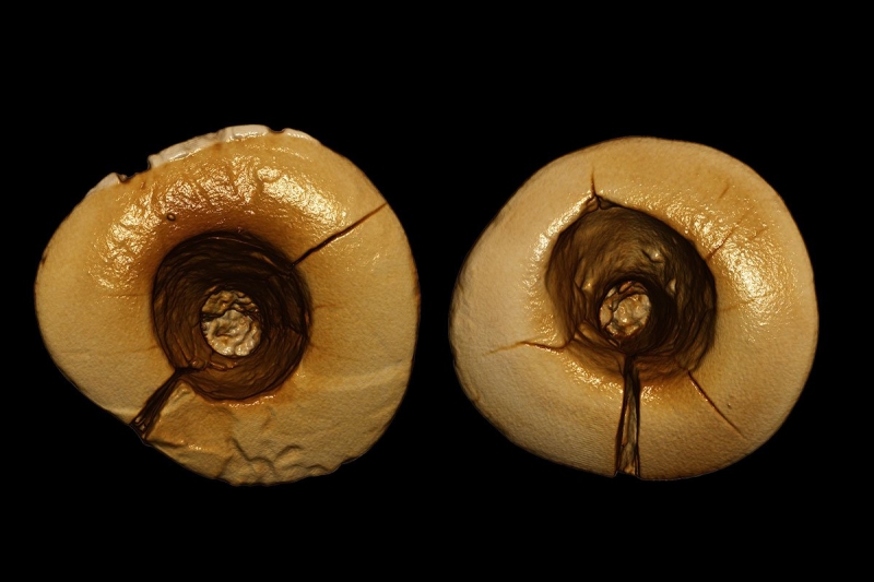 Le prime otturazioni dentali risalgono al Paleolitico